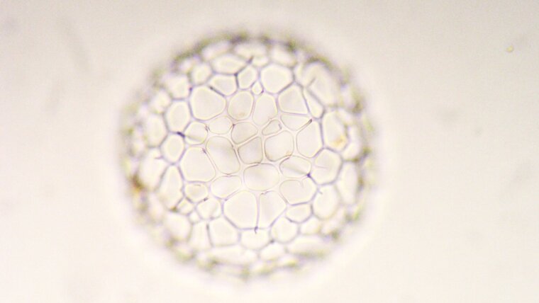 Microphotograph of a radiolarian